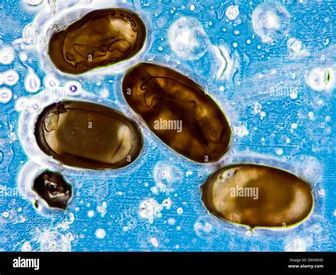 Microscopic image of flea eggs