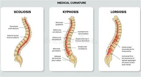 Diagram illustrating different node types for curve manipulation