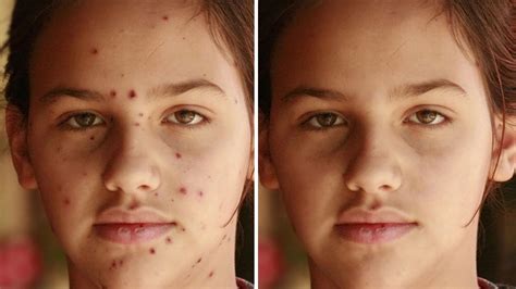 Before and after image showing the removal of a power line using the Spot Healing Brush tool