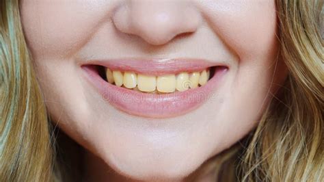 Close-up of a person smiling with slightly yellow teeth