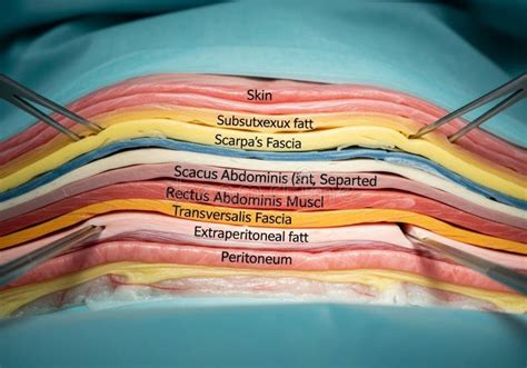 Diagram illustrating frequency separation layers