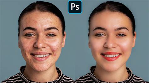 Before and after example of skin retouching in Photoshop