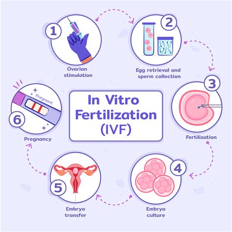 Diagram illustrating the process of IVF