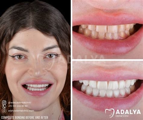 Split image showing a composite before and after noise application